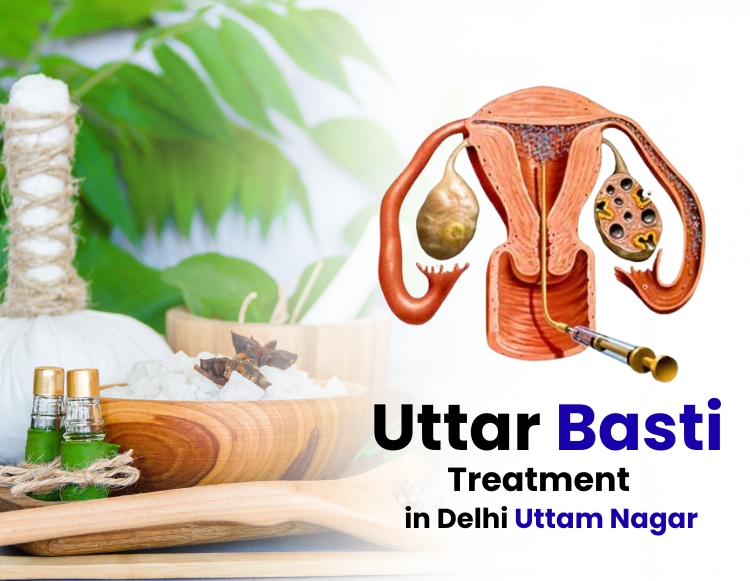Uttar Basti Treatment In Uttam Nagar Delhi